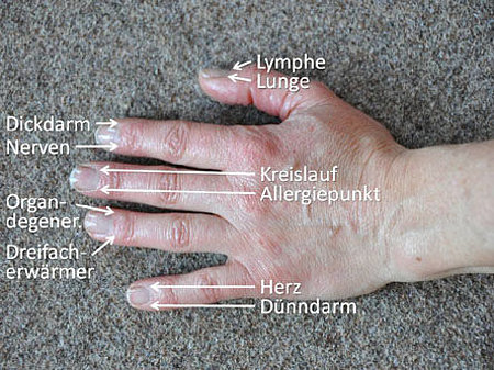 Abb. 2: Wichtige Akupunkturpunkte der Finger; Organdegener. = Organdegeneration. Wenn dieser Wert bei der EAV (Elektroakupunkturdiagnostik nach Dr. Voll) auffallend ist, bedarf es der dringenden Abklärung, welches Organ chronisch-degenerativ verändert i