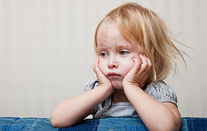 Masern - Diagnose und naturheilkundliche Therapie