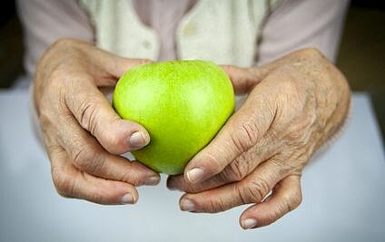 Rheumatoid arthritis hands and fruits