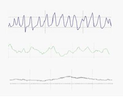 Abb. 1: Beispiel für drei unterschiedliche Verläufe des Herzfrequenzverlaufs. (Quelle: Metabalance-Institut)