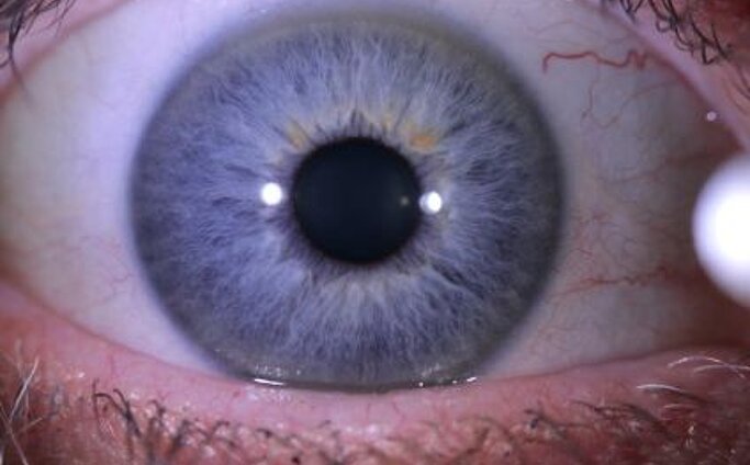 Close-up eines Auges