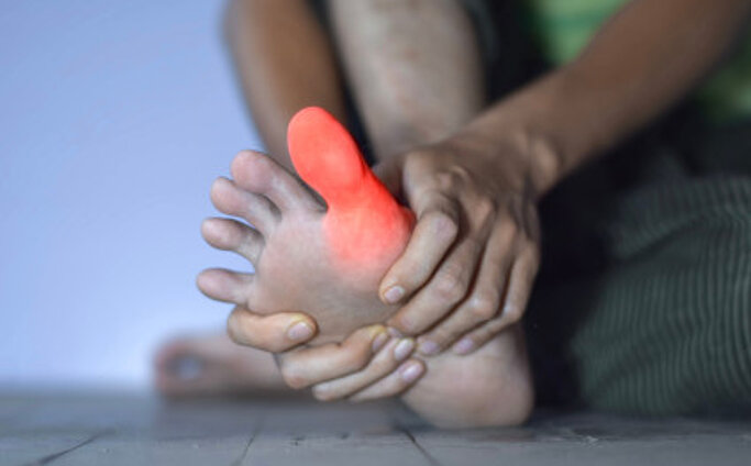 Entzündung des großen Zehs eines asiatischen Mannes. Konzept von Fußgelenksschmerzen, Stolpern, Arthritis, Hyperurikämie oder Gicht.