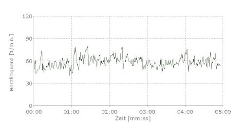 Abb. 4: Beispiel für eine optimale Regulation der Herzfrequenz (Quelle: Metabalance-Instititut)