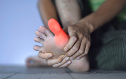 Entzündung des großen Zehs eines asiatischen Mannes. Konzept von Fußgelenksschmerzen, Stolpern, Arthritis, Hyperurikämie oder Gicht.